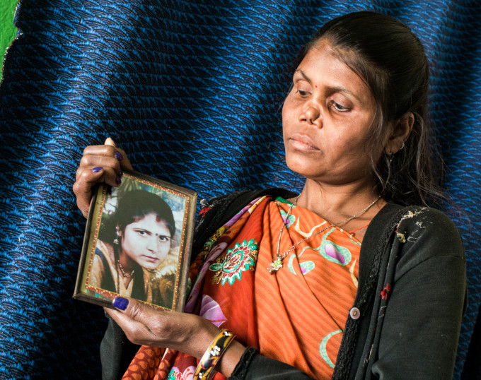 leprosy delhi india (2)