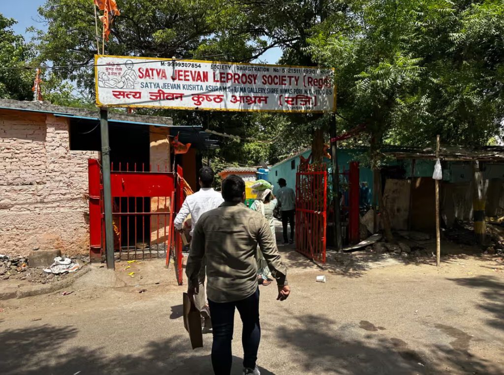 leprosy in delhi india