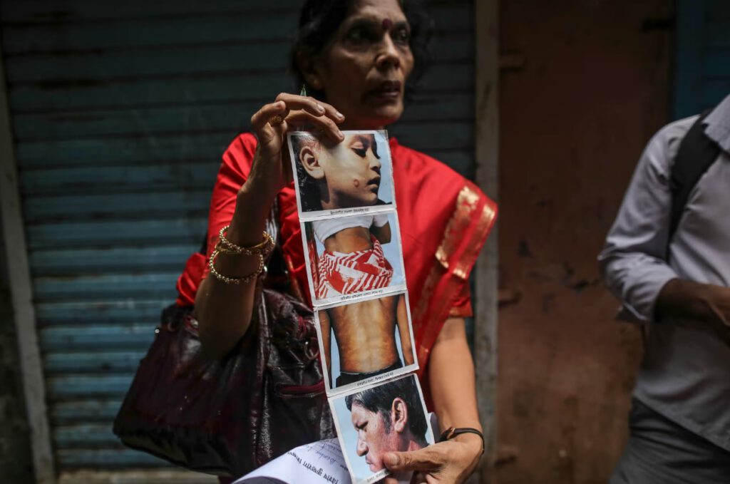 Leprosy Struggles in the Heart of Delhi: A Hidden Crisis and the Efforts to Bring Change
